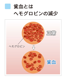 不足 症状 鉄分